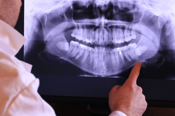 Best Emergency Dentist for Special Needs Patients in Mountain Road, VA