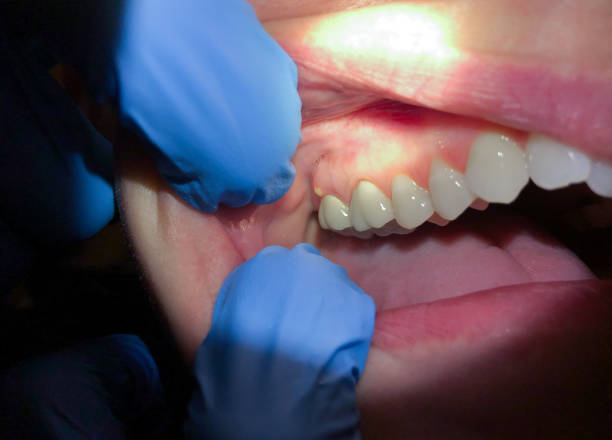 Best Emergency Dental Services for Seniors in Mountain Road, VA
