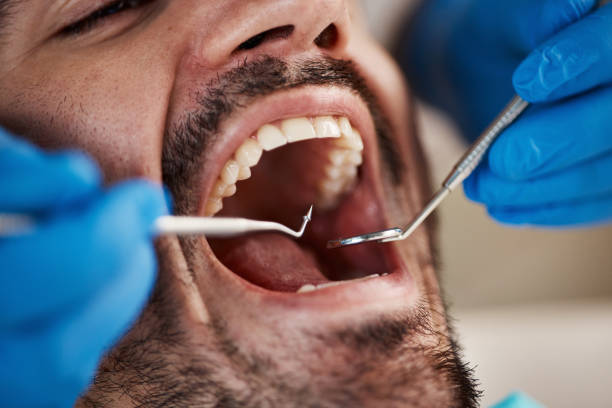 Best Broken or Cracked Tooth Emergency Dentist in Mountain Road, VA